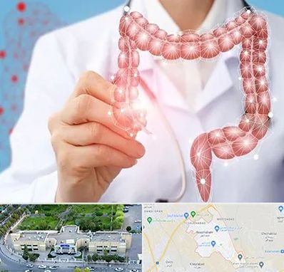 جراح سرطان روده بزرگ در نسیم شهر