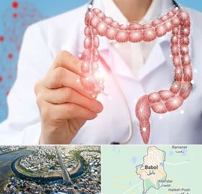 جراح سرطان روده بزرگ در بابل