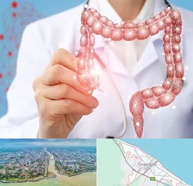 جراح سرطان روده بزرگ در تنکابن