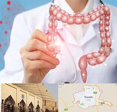 جراح سرطان روده بزرگ در ساوه
