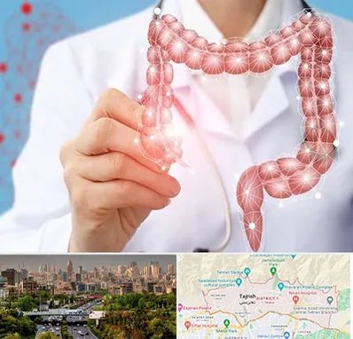 جراح سرطان روده بزرگ در منطقه 1 تهران 