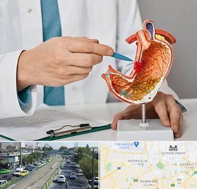 دکتر سرطان معده در جنوب تهران 