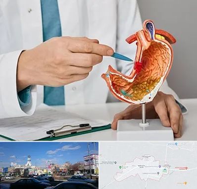 دکتر سرطان معده در ماهدشت کرج 