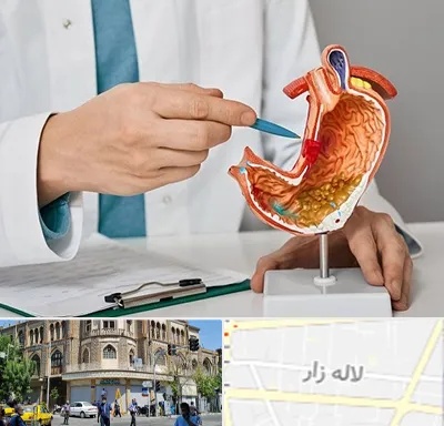 دکتر سرطان معده در لاله زار