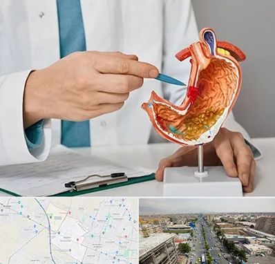 دکتر سرطان معده در حصارک کرج 