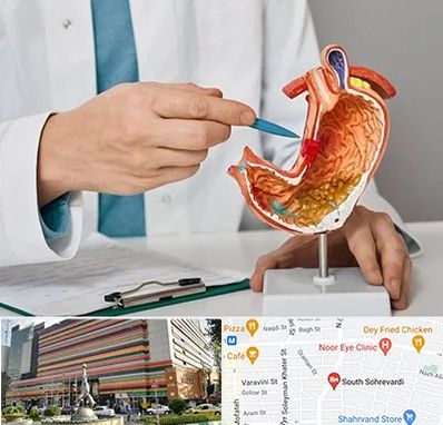 دکتر سرطان معده در سهروردی 