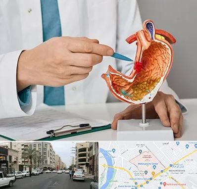 دکتر سرطان معده در زیتون کارمندی اهواز 