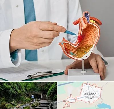 دکتر سرطان معده در علی آباد کتول