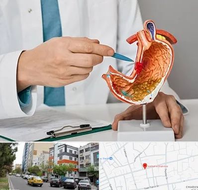 دکتر سرطان معده در هفده شهریور تبریز