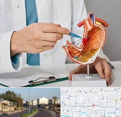 دکتر سرطان معده در ضیابری رشت 