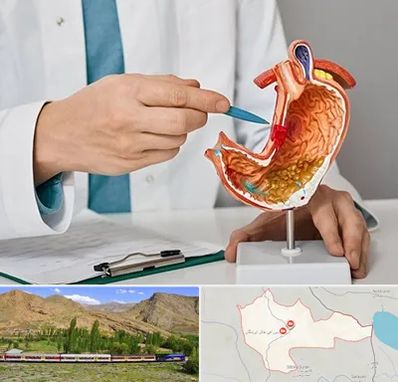 دکتر سرطان معده در خاش