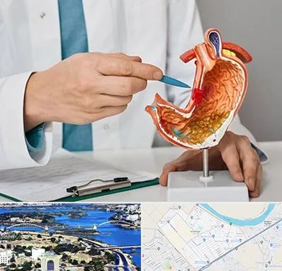 دکتر سرطان معده در کوروش اهواز 