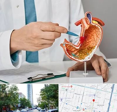 دکتر سرطان معده در امامت مشهد 