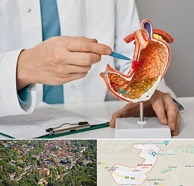 دکتر سرطان معده در دماوند