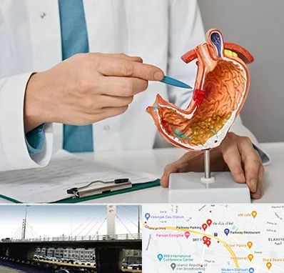 دکتر سرطان معده در پارک وی 