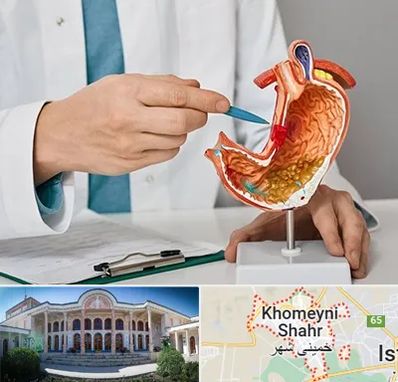 دکتر سرطان معده در خمینی شهر