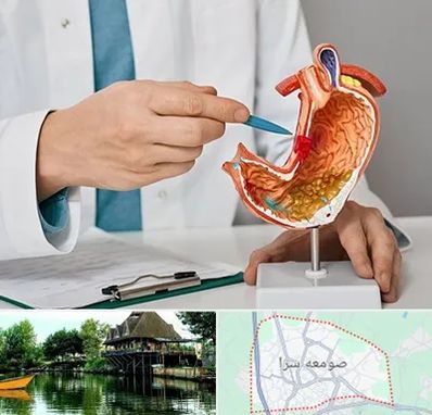 دکتر سرطان معده در صومعه سرا