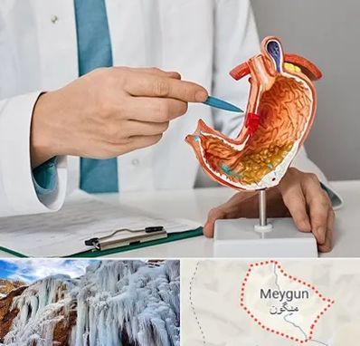 دکتر سرطان معده در میگون