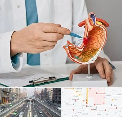 دکتر سرطان معده در توحید 