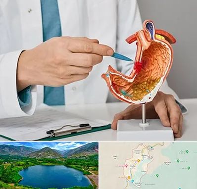 دکتر سرطان معده در رودبار