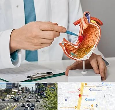 دکتر سرطان معده در ستاری 