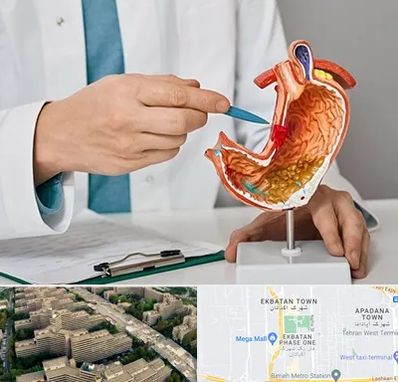 دکتر سرطان معده در اکباتان 