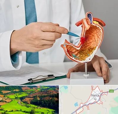 دکتر سرطان معده در نکا