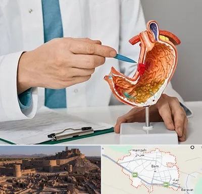 دکتر سرطان معده در بم