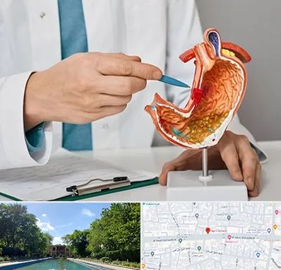 دکتر سرطان معده در هشت بهشت اصفهان 