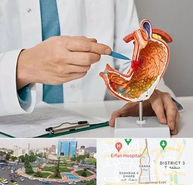 دکتر سرطان معده در ونک 