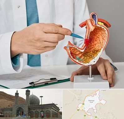 دکتر سرطان معده در شهرضا