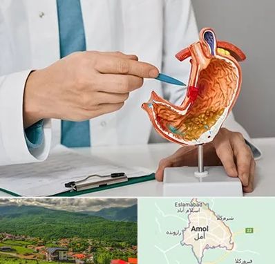 دکتر سرطان معده در آمل