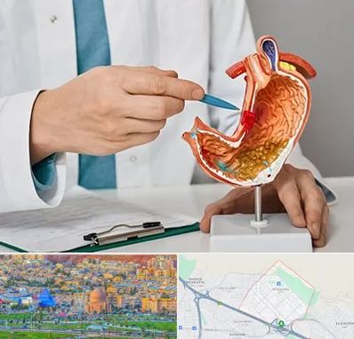 دکتر سرطان معده در رشدیه تبریز