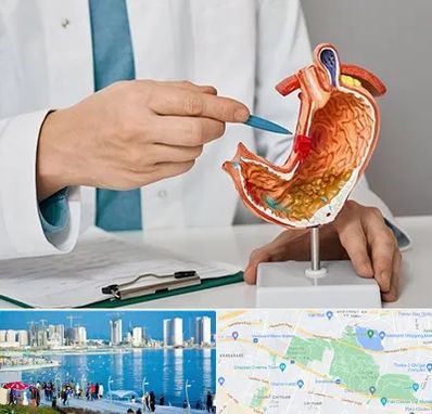 دکتر سرطان معده در چیتگر 