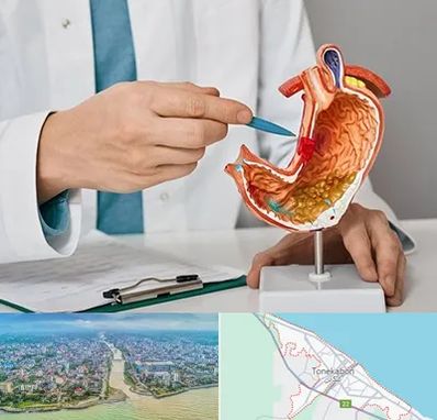 دکتر سرطان معده در تنکابن