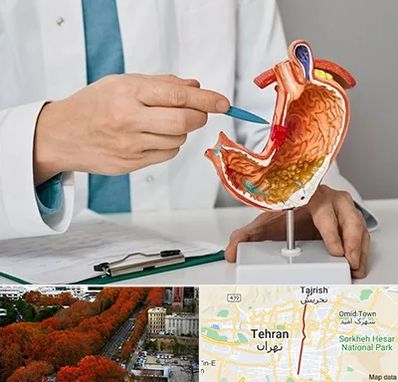 دکتر سرطان معده در ولیعصر 