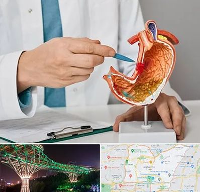 دکتر سرطان معده در منطقه 3 تهران 