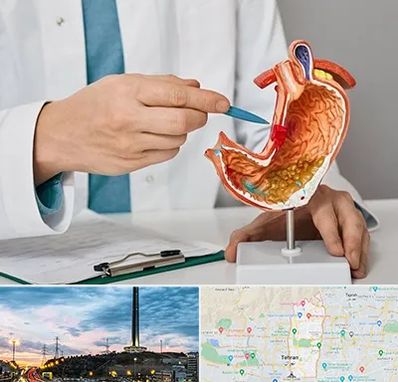 دکتر سرطان معده در منطقه 2 تهران 