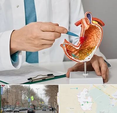 دکتر سرطان معده در نظرآباد کرج 