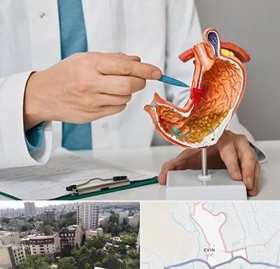 دکتر سرطان معده در اوین