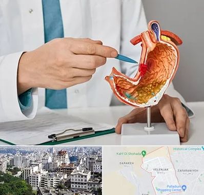 دکتر سرطان معده در ولنجک 