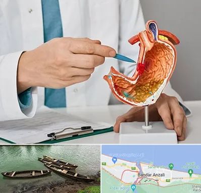 دکتر سرطان معده در بندر انزلی