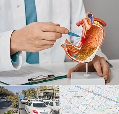 دکتر سرطان معده در مفتح مشهد 