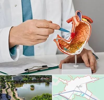 دکتر سرطان معده در لنگرود