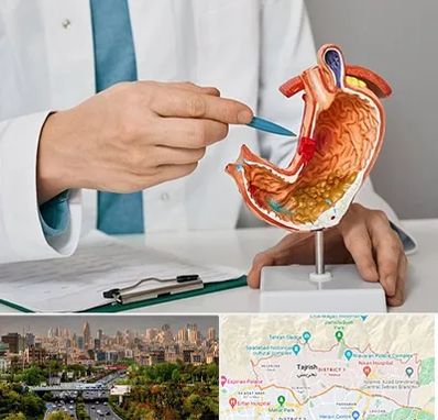 دکتر سرطان معده در منطقه 1 تهران 