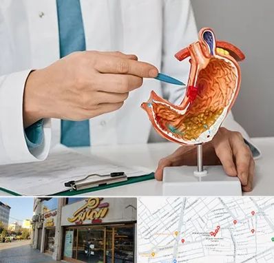 دکتر سرطان معده در عطاران قم