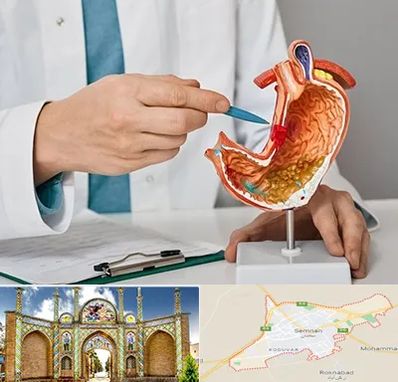 دکتر سرطان معده در سمنان