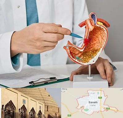 دکتر سرطان معده در ساوه