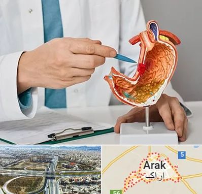 دکتر سرطان معده در اراک
