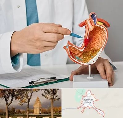 دکتر سرطان معده در تویسرکان